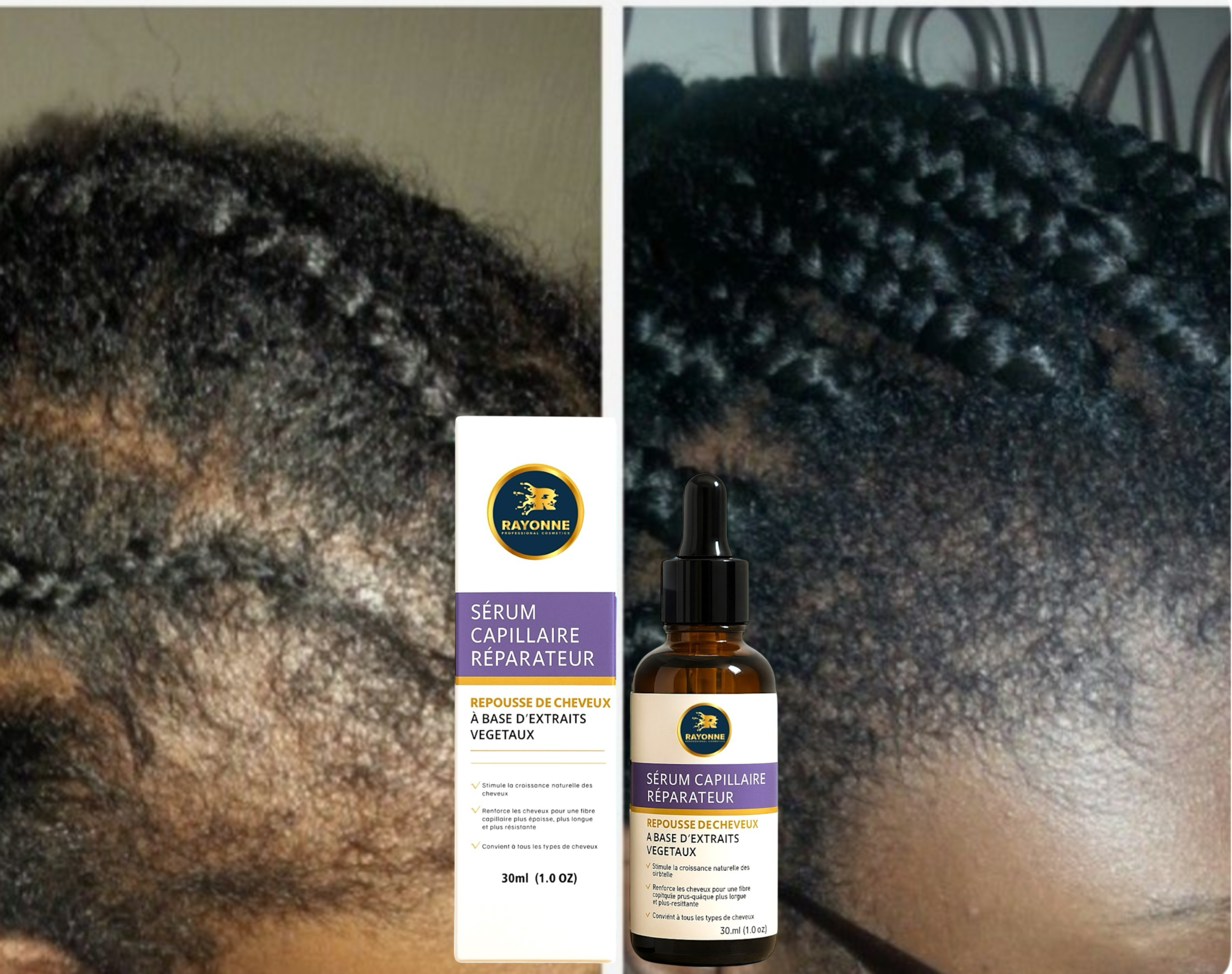 SÉRUM DE REPOUSSE pour cheveux abîmés et cassants