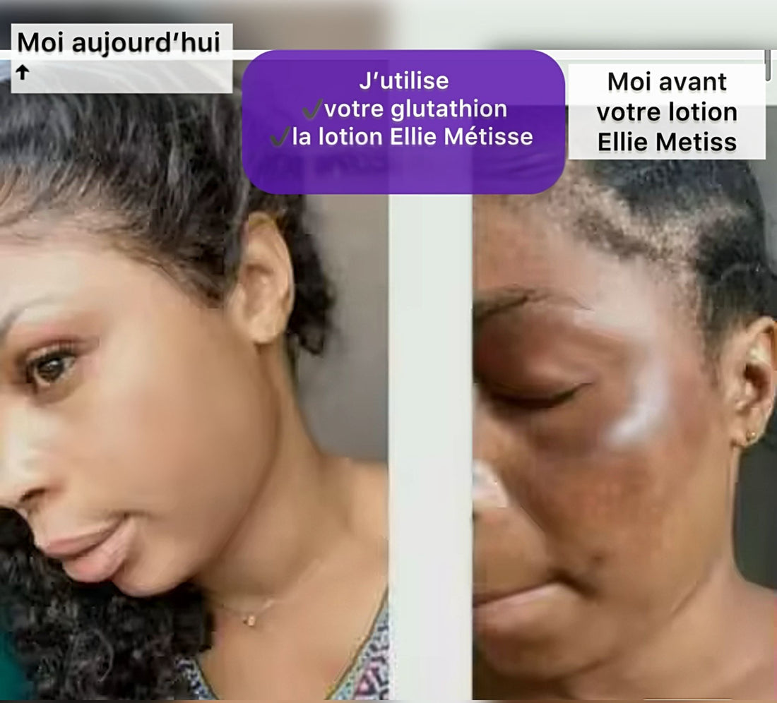 PACK VISAGE ÉCLAT ELLIE MÉTISSE — Routine Anti-taches rajeunissante & Éclaircissante