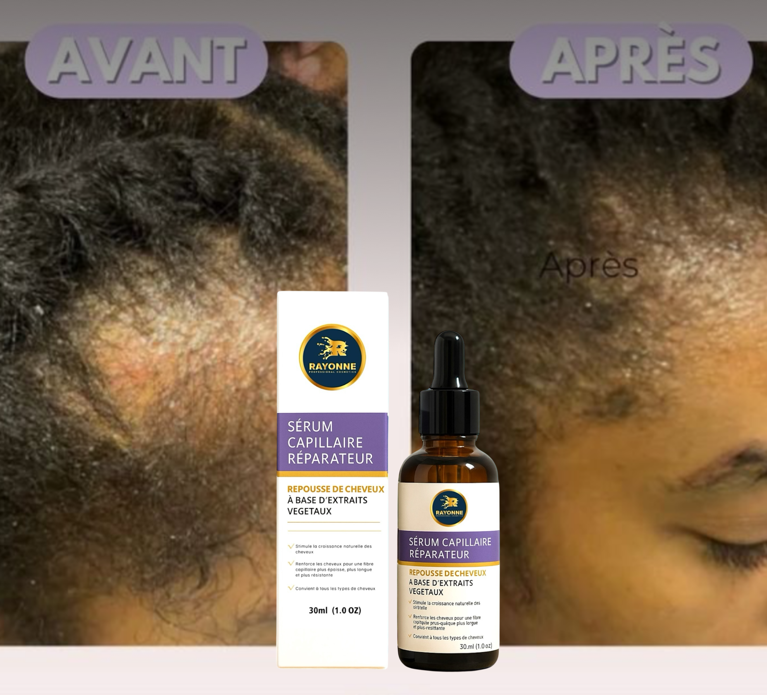 SÉRUM DE REPOUSSE pour cheveux abîmés et cassants