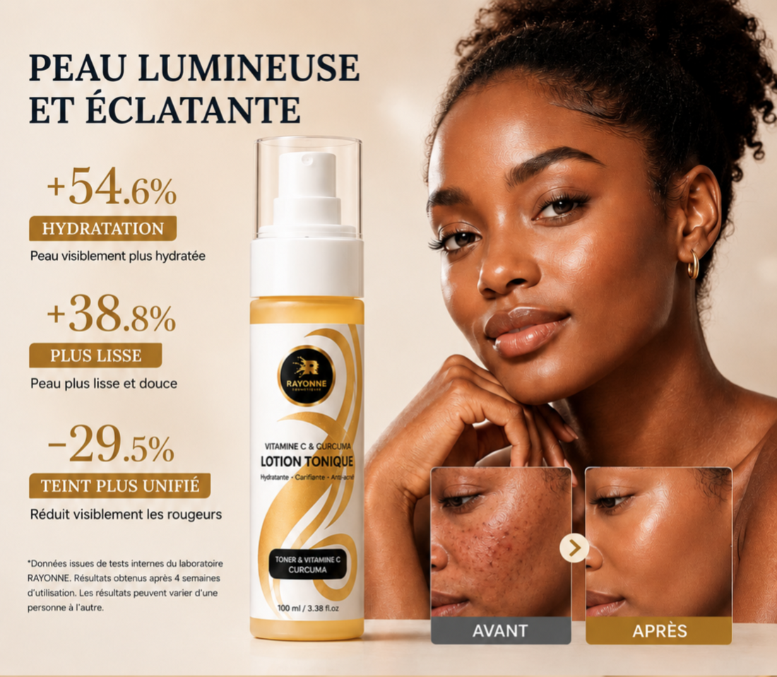 Lotion Tonique Vitamine C & Curcuma – Hydratante, Clarifiante & Anti-Acné