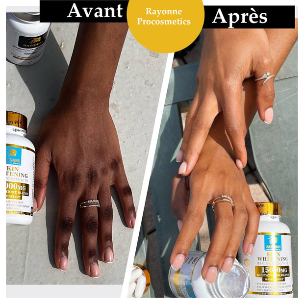 glutathion avant aprs Les dangers des complments alimentaires pour la peau  Crme Hydratante Gamme Teint Caramel